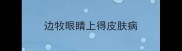 边牧眼睛上得皮肤病