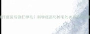 猫咪打疫苗后疯狂掉毛科学疫苗与掉毛的关系及应对指南