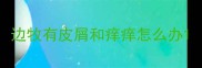 边牧有皮屑和痒痒怎么办