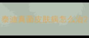 泰迪真菌皮肤病怎么治